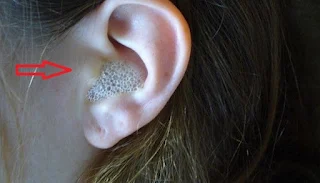 Flacon d'eau oxygénée et coton pour le soin des oreilles